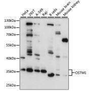 Western blot analysis of various lysates using OSTM1 Antibody at 1/3000 dilution. Secondary antibody: HRP-conjugated Goat anti-Rabbit IgG (H+L) at 1/10000 dilution. Lysates/proteins: 25 µg per lane. Blocking buffer: 3% nonfat dry milk in TBST. Exposure time: 10s.