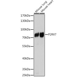 P2X Purinoceptor 7 (P2RX7) Antibody