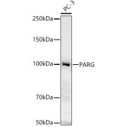 Western blot analysis of lysates from PC-3 cells, using PARG Antibody at 1/400 dilution. Secondary antibody: HRP-conjugated Goat anti-Rabbit IgG (H+L) at 1/10000 dilution. Lysates/proteins: 25 µg per lane. Blocking buffer: 3% nonfat dry milk in TBST. Exposure time: 30s.