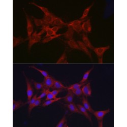 E3 Ubiquitin-Protein Ligase Parkin (PRKN) Antibody