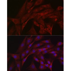 E3 Ubiquitin-Protein Ligase Parkin (PRKN) Antibody