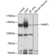Western blot analysis of various lysates using PARP1 Antibody at 1/1000 dilution. Secondary antibody: HRP-conjugated Goat anti-Rabbit IgG (H+L) at 1/10000 dilution. Lysates/proteins: 25 µg per lane. Blocking buffer: 3% nonfat dry milk in TBST. Exposure time: 20s.