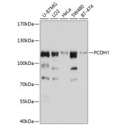 Western blot analysis of various lysates using PCDH1 Antibody at 1/1000 dilution. Secondary antibody: HRP-conjugated Goat anti-Rabbit IgG (H+L) at 1/10000 dilution. Lysates/proteins: 25 µg per lane. Blocking buffer: 3% nonfat dry milk in TBST. Exposure time: 5s.