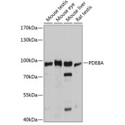 Western blot analysis of various lysates using PDE8A Antibody at 1/3000 dilution. Secondary antibody: HRP-conjugated Goat anti-Rabbit IgG (H+L) at 1/10000 dilution. Lysates/proteins: 25 µg per lane. Blocking buffer: 3% nonfat dry milk in TBST. Exposure time: 5s.