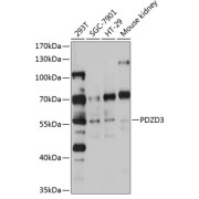 Western blot analysis of various lysates using PDZD3 Antibody at 1/1000 dilution. Secondary antibody: HRP-conjugated Goat anti-Rabbit IgG (H+L) at 1/10000 dilution. Lysates/proteins: 25 µg per lane. Blocking buffer: 3% nonfat dry milk in TBST. Exposure time: 30s.