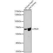 Western blot analysis of various lysates using PKLR Antibody at 1/3000 dilution. Secondary antibody: HRP-conjugated Goat anti-Rabbit IgG (H+L) at 1/10000 dilution. Lysates/proteins: 25 µg per lane. Blocking buffer: 3% nonfat dry milk in TBST. Exposure time: 50s.