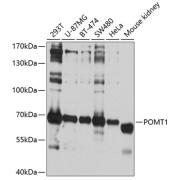 Western blot analysis of various lysates using POMT1 Antibody at 1/1000 dilution. Secondary antibody: HRP-conjugated Goat anti-Rabbit IgG (H+L) at 1/10000 dilution. Lysates/proteins: 25 µg per lane. Blocking buffer: 3% nonfat dry milk in TBST. Exposure time: 5s.