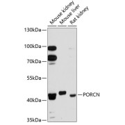 Western blot analysis of various lysates using PORCN Antibody at 1/3000 dilution. Secondary antibody: HRP-conjugated Goat anti-Rabbit IgG (H+L) at 1/10000 dilution. Lysates/proteins: 25 µg per lane. Blocking buffer: 3% nonfat dry milk in TBST. Exposure time: 90s.