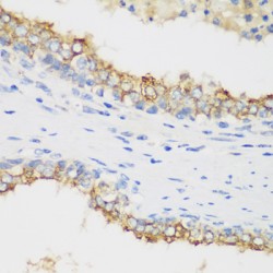 Phosphatidylinositol-3,4,5-Trisphosphate 3-Phosphatase And Dual-Specificity Protein Phosphatase PTEN (PTEN) Antibody
