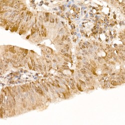 Protein Tyrosine Kinase 2 Beta (PTK2) Antibody