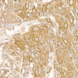 Protein Tyrosine Kinase 2 Beta (PTK2) Antibody