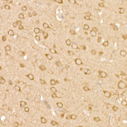 Protein Tyrosine Kinase 2 Beta (PTK2) Antibody