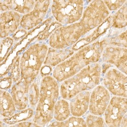 Protein Tyrosine Kinase 2 Beta (PTK2) Antibody