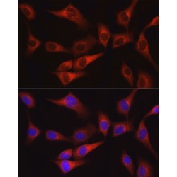 Protein Tyrosine Kinase 2 Beta (PTK2) Antibody