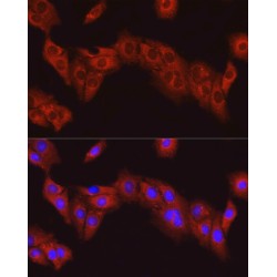 Protein Tyrosine Kinase 2 Beta (PTK2) Antibody