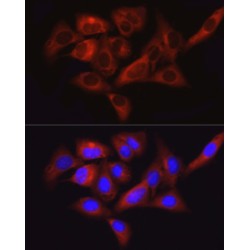 Protein Tyrosine Kinase 2 Beta (PTK2) Antibody