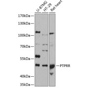 Western blot analysis of various lysates using PTPRR Antibody at 1/3000 dilution. Secondary antibody: HRP-conjugated Goat anti-Rabbit IgG (H+L) at 1/10000 dilution. Lysates/proteins: 25 µg per lane. Blocking buffer: 3% nonfat dry milk in TBST. Exposure time: 90s.