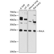 Western blot analysis of various lysates using RALA Antibody at 1/3000 dilution. Secondary antibody: HRP-conjugated Goat anti-Rabbit IgG (H+L) at 1/10000 dilution. Lysates/proteins: 25 µg per lane. Blocking buffer: 3% nonfat dry milk in TBST. Exposure time: 60s.