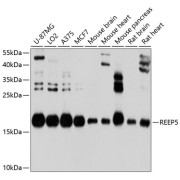 Western blot analysis of various lysates using REEP5 Antibody at 1/1000 dilution. Secondary antibody: HRP-conjugated Goat anti-Rabbit IgG (H+L) at 1/10000 dilution. Lysates/proteins: 25 µg per lane. Blocking buffer: 3% nonfat dry milk in TBST. Exposure time: 1s.