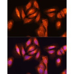 Transcription Factor p65 / NFKB3 (RELA) Antibody