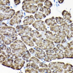 RPS15A Antibody