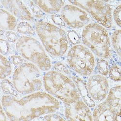 Ribosomal Protein S18 (RPS18) Antibody