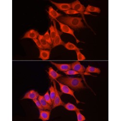 Ribosomal Protein S18 (RPS18) Antibody