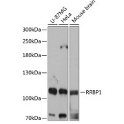 Western blot analysis of various lysates using RRBP1 Antibody at 1/3000 dilution. Secondary antibody: HRP-conjugated Goat anti-Rabbit IgG (H+L) at 1/10000 dilution. Lysates/proteins: 25 µg per lane. Blocking buffer: 3% nonfat dry milk in TBST. Exposure time: 1s.