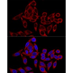 Ribosome-Binding Protein 1 (RRBP1) Antibody