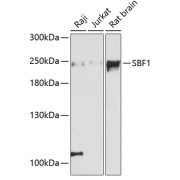 Western blot analysis of various lysates using SBF1 Antibody at 1/3000 dilution. Secondary antibody: HRP-conjugated Goat anti-Rabbit IgG (H+L) at 1/10000 dilution. Lysates/proteins: 25 µg per lane. Blocking buffer: 3% nonfat dry milk in TBST. Exposure time: 90s.