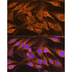 Succinate Dehydrogenase Complex Subunit B (SDHB) Antibody