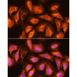 SEC11 Homolog A, Signal Peptidase Complex Subunit (SEC11A) Antibody