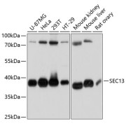 Western blot analysis of various lysates using SEC13 Antibody at 1/3000 dilution. Secondary antibody: HRP-conjugated Goat anti-Rabbit IgG (H+L) at 1/10000 dilution. Lysates/proteins: 25 µg per lane. Blocking buffer: 3% nonfat dry milk in TBST. Exposure time: 10s.