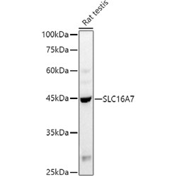 Monocarboxylate Transporter 2 (SLC16A7) Antibody