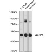 Western blot analysis of various lysates using SLC30A6 Antibody at 1/3000 dilution. Secondary antibody: HRP-conjugated Goat anti-Rabbit IgG (H+L) at 1/10000 dilution. Lysates/proteins: 25 µg per lane. Blocking buffer: 3% nonfat dry milk in TBST. Exposure time: 30s.