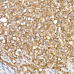 SLC39A14 Antibody