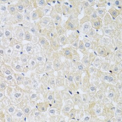 Electrogenic Sodium Bicarbonate Cotransporter 4 / NBC4 (SLC4A5) Antibody