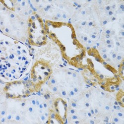 Electrogenic Sodium Bicarbonate Cotransporter 4 / NBC4 (SLC4A5) Antibody
