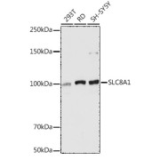 Western blot analysis of various lysates using SLC8A1 Antibody at 1/5000 dilution. Secondary antibody: HRP-conjugated Goat anti-Rabbit IgG (H+L) at 1/10000 dilution. Lysates/proteins: 25 µg per lane. Blocking buffer: 3% nonfat dry milk in TBST. Exposure time: 1s.