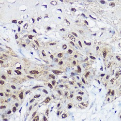 SWI/SNF-Related Matrix-Associated Actin-Dependent Regulator of Chromatin Subfamily A Member 1 (SMARCA1) Antibody