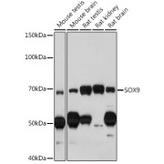 Western blot analysis of various lysates using SOX9 Antibody at 1/1000 dilution. Secondary antibody: HRP-conjugated Goat anti-Rabbit IgG (H+L) at 1/10000 dilution. Lysates/proteins: 25 µg per lane. Blocking buffer: 3% nonfat dry milk in TBST. Exposure time: 120s.