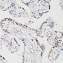 Spondin-2 (SPON2) Antibody