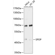 Western blot analysis of various lysates using SPOP Antibody at 1/3000 dilution. Secondary antibody: HRP-conjugated Goat anti-Rabbit IgG (H+L) at 1/10000 dilution. Lysates/proteins: 25 µg per lane. Blocking buffer: 3% nonfat dry milk in TBST. Exposure time: 60s.