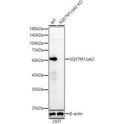 Sequestosome 1 (SQSTM1) Antibody