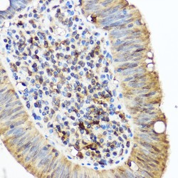 Sequestosome 1 (SQSTM1) Antibody