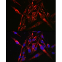 Sequestosome 1 (SQSTM1) Antibody