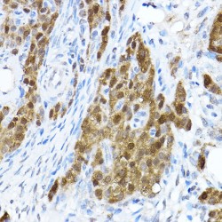 Signal Transducer And Activator of Transcription 1 (STAT1) Antibody