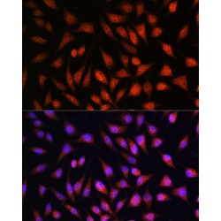 Signal Transducer And Activator of Transcription 1 (STAT1) Antibody