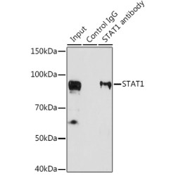 Signal Transducer And Activator of Transcription 1 (STAT1) Antibody