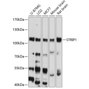 Western blot analysis of various lysates using STRIP1 Antibody at 1/1000 dilution. Secondary antibody: HRP-conjugated Goat anti-Rabbit IgG (H+L) at 1/10000 dilution. Lysates/proteins: 25 µg per lane. Blocking buffer: 3% nonfat dry milk in TBST. Exposure time: 20s.